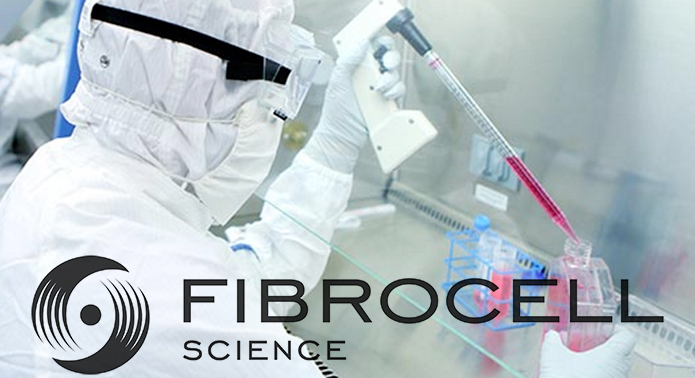 News – @Fibrocell #Fibrocell Announces Initiation of Patient Recruitment in Phase I/II Clinical Trial of FCX-007 for Treatment of Recessive Dystrophic Epidermolysis Bullosa